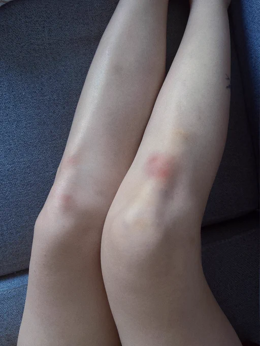 e74182's tweet photo. 姿勢是很舒服   但是我的腳都紅紅的了
#單親媽媽 #��書  #美腿 https://t.co/bk9ftfpSkJ