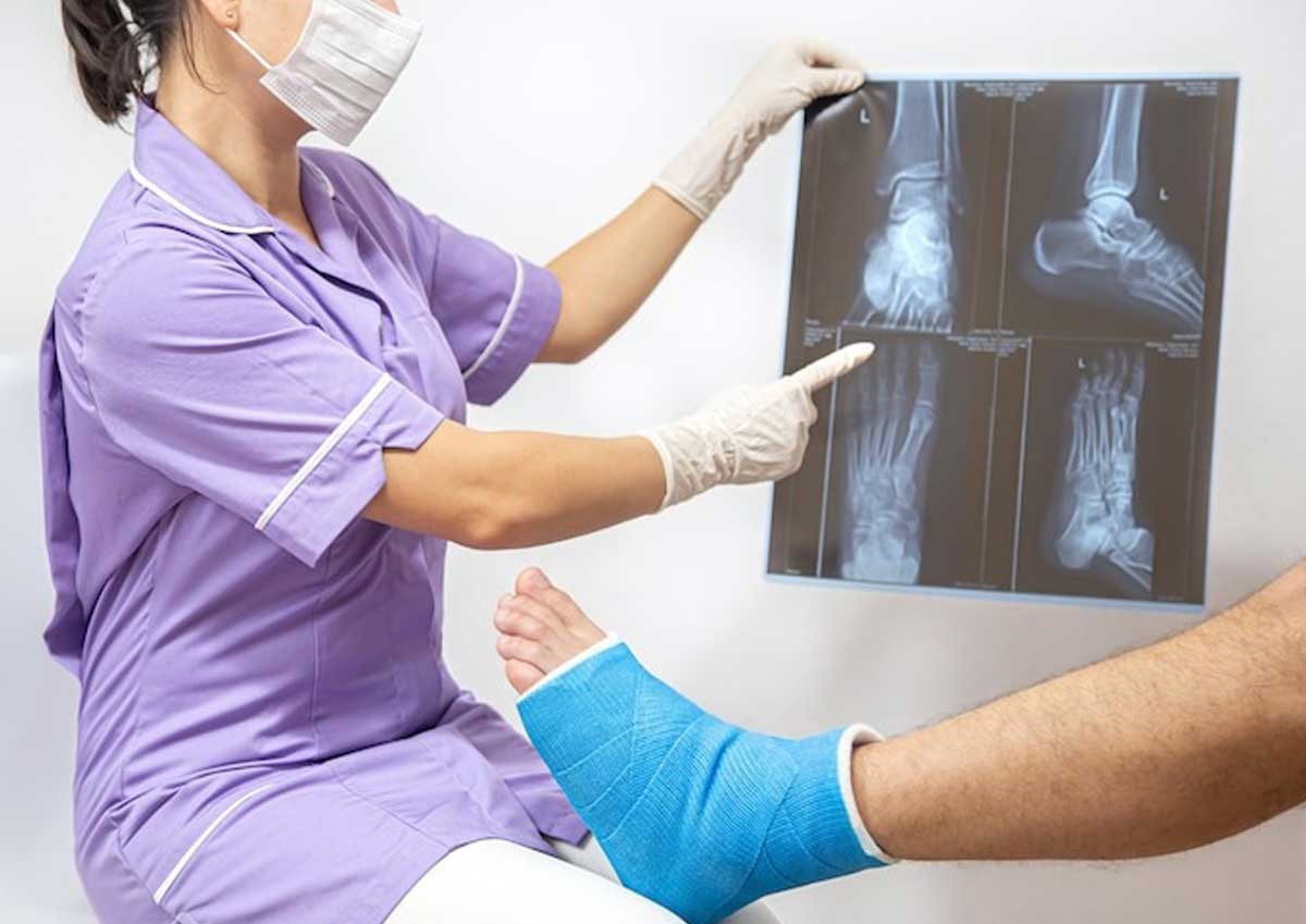 We offer a variety of treatment options for broken bones, including surgery, casting, and physical therapy. We'll work with you to find the best treatment for your individual needs. crescentemergencyroom.com/services/broke… #USA #trending #BrokenBoneRecovery #BoneHealing #FractureRecovery