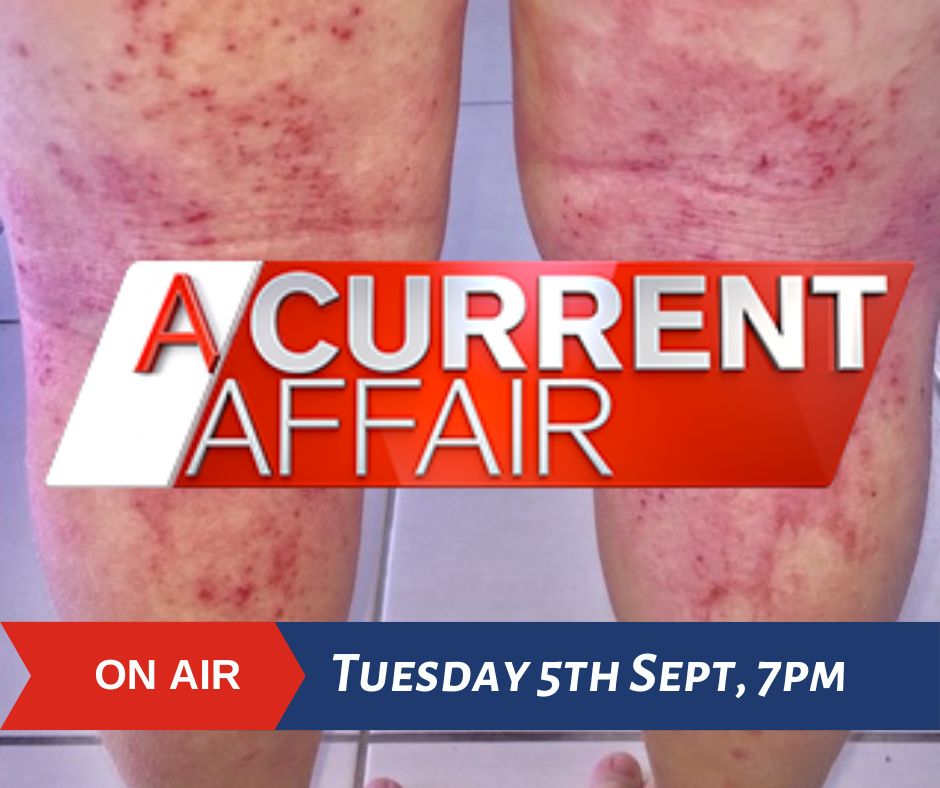 Eczema Support Australia tweet media