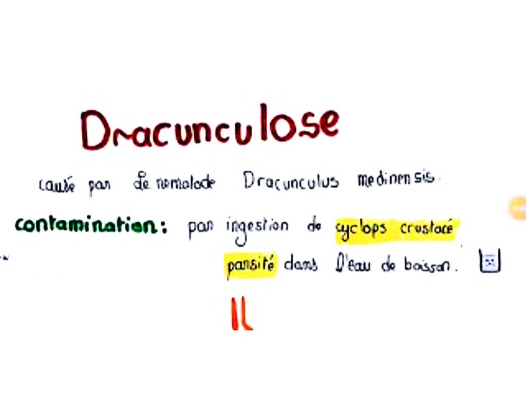 La #dracunculose, une des #NTDs, c'est une infection causée par le ver de Guinée, qui est transmise par l'ingestion d'eau contaminée. Elle provoque de graves ulcères cutanés.
Éliminé dans certains pays de l'Afrique mais encore endémique dans d'autres.
#BeatNTDs @ms_givensam #NTDs