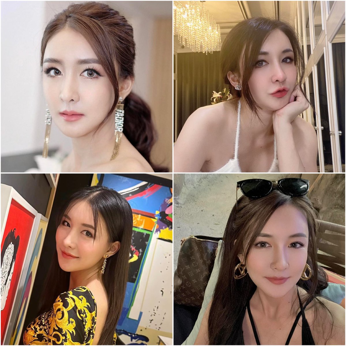 DAofficialTH's tweet photo. โครงหน้าแก้ไขได้ ถ้าหมอเก่งพอ #DAoriginal

โครงหน้า (หมอลี ซัง วู มือ 1 กระดูกโครงหน้าและขากรรไกร ประจำ DA)
- กราม (เคสแก้)
- ปรับช่วงระหว่างกรามและคาง
- เอาพินตรงโหนกแก้มออก

DA โรงพยาบาลศัลยกรรมขนาดใหญ่ ทันสมัย ปลอดภัย และมีวิสัญญีแพทย์ประจำเยอะที่สุดในเกาหลี 🇰🇷 https://t.co/Gvniw8OeEP