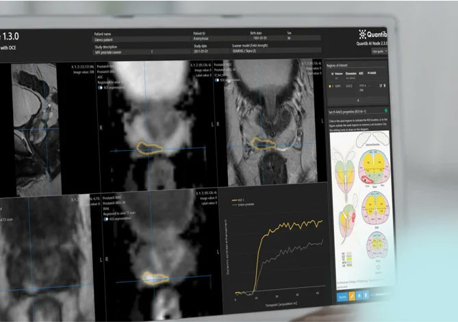RayscapeAI's tweet photo. 🔍 Here is 𝐏𝐚𝐫𝐭 𝟐 of our comprehensive guide to AI-powered radiology!  

➡️Dive into the future of medical imaging in our latest guide:https://t.co/kki9R6PipH

🫁 @Lunit_AI  Global's INSIGHT CXR redefines chest X-ray interpretation, prioritizing accuracy in diagnosis.
🧠 @aidocmed 's Always-on AI is your silent diagnostic partner, revolutionizing radiology workflows. 
👨🏻‍⚕️@contextflow ADVANCE Chest CT is your visual detective for lung conditions, enhancing diagnostic precision. 
🩻 @oxipitAI 's ChestEye Quality raises the bar in chest X-ray quality assurance. 
🦴 @qure_ai  empowers diagnosis across Lung, Heart, Neuro, and MSK domains. 
🏥 @Quantib 's transformative solutions drive early detection in prostate and neuroimaging.

#AIinRadiology #HealthcareInnovation #MedicalImaging #AIRevolution #RadiologyGuide