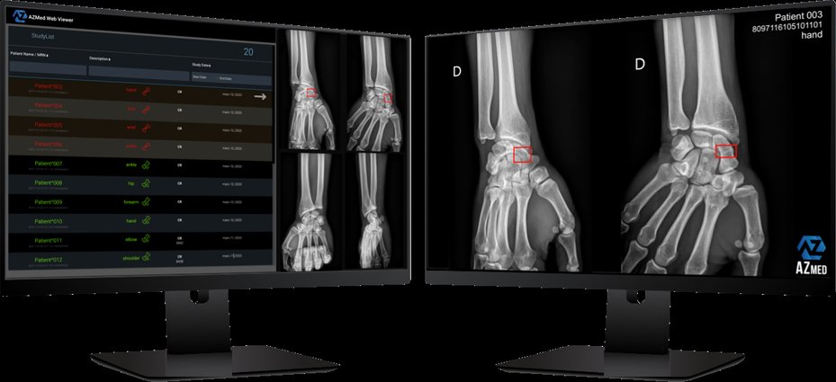 RayscapeAI's tweet photo. 🤔 Curious about the future of medical imaging?

➡️Read our top here: https://t.co/lQJgwU0AN3

-@gleamer_ai  for enhancing precision and efficiency in bone scanning 🦴
-@annalise_ai  for empowering radiologists in interpreting CXR 🫁
-@viz_ai  for reducing errors in the analysis of brain scans 🧠

and more...

@AZmed_AI  │ @KheironMedical │ @ArterysInc  │ @CARPLai │ @deepchealth  │ @Blackford  │ @inceptomedical
