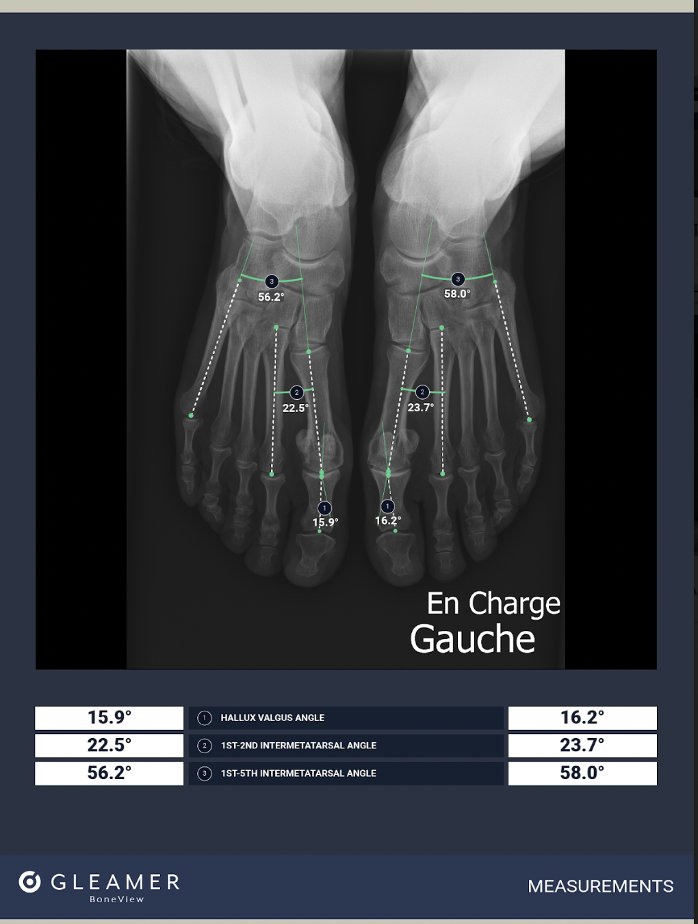 RayscapeAI's tweet photo. 🤔 Curious about the future of medical imaging?

➡️Read our top here: https://t.co/lQJgwU0AN3

-@gleamer_ai  for enhancing precision and efficiency in bone scanning 🦴
-@annalise_ai  for empowering radiologists in interpreting CXR 🫁
-@viz_ai  for reducing errors in the analysis of brain scans 🧠

and more...

@AZmed_AI  │ @KheironMedical │ @ArterysInc  │ @CARPLai │ @deepchealth  │ @Blackford  │ @inceptomedical