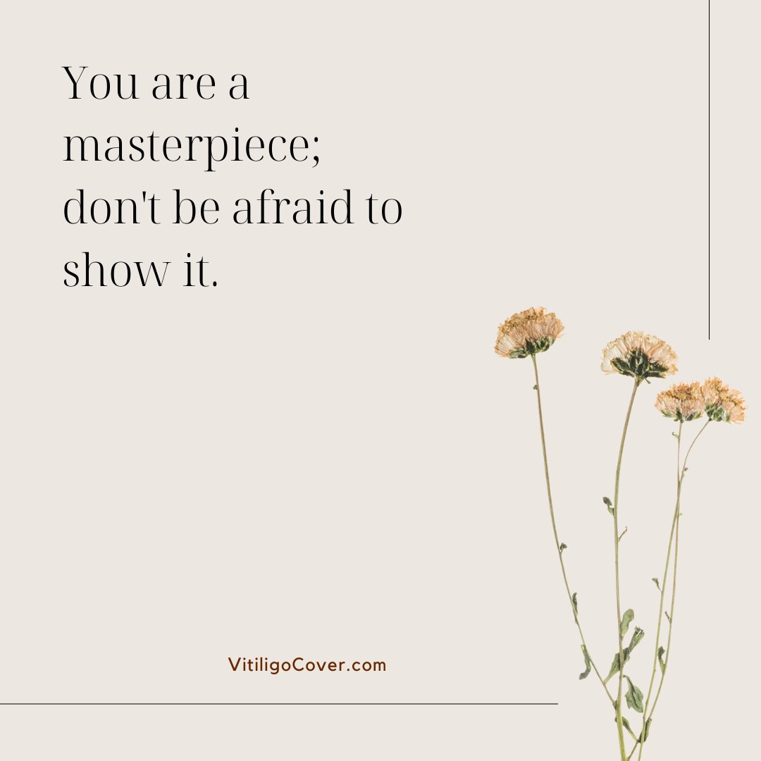 VitiligoVoices's tweet photo. #VitiligoBeauty https://t.co/hbE0ndnzov