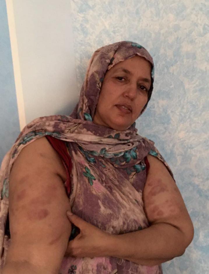 Sultanakhayya1's tweet photo. صور من جرائم دولة الإحتلال المغربية في حق المدنيين الصحراويبن العزل المطالبين بالحرية والإستقلال يوم أمس الإثنين 04 سبتمبر 2023 بالتزامن مع زيارة المبعوث الأممي للعيون المحتلة. https://t.co/BWpJI1dS64