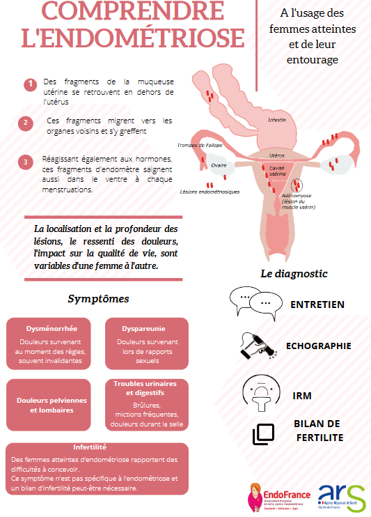 Groupement_IST's tweet image. On la soigne, on la traite, mais on ne guérit pas de l’endométriose.
Découvrez en images ces quelques chiffres pour mieux comprendre les impacts de l’#endométriose,  cette maladie inflammatoire et parfois sociale qui pèse sur le quotidien personnel et professionnel des #femmes