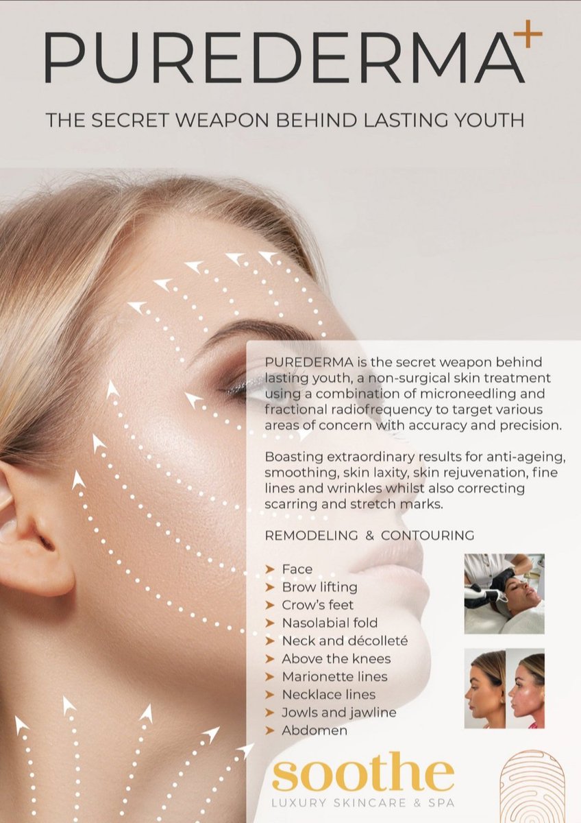 WestWfc's tweet photo. Our fabulous sponsors @soothe_skin have a promotional event coming up on Weds 13th Sept, 5-7pm. 

Live demo's of the Radiofrequency Microneedling technology! 

Drop in to meet this amazing team if you can!

#WestBridgford #Luxury #Skincare #Spa #TreatYourself #Nottingham https://t.co/VsgzpvvyC5