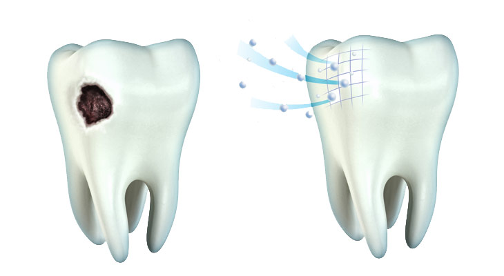 dental_canada's tweet photo. Understanding the importance of #ToothEnamel and embracing the process of #Remineralization, can help one to enjoy a smile that features stronger and happier teeth.🦷✨

🌍 Read More: https://t.co/0BbCm8qY0o

#CanadaDental #TorontoDental #TorontoDentist #GTA #GTADentist https://t.co/6vrrww1kAU