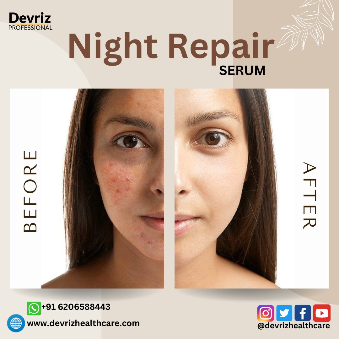 Devriz02's tweet photo. 👩🏻‍🦰? If you are worried about pigmentation then use this serum 👇🏻 ⬇👇🏻
➡https://t.co/QeYzg5g5uN
⭕Benifits 
✅Its Reduces Dark Spots:
✅Provides sun protection
✅Enhance  complexion
✨REDUCES DARK SPOTS: Devriz pigmentation 
#pigmentation #pigmentationtreatment  #skinproblem https://t.co/rFPEqC9vQM