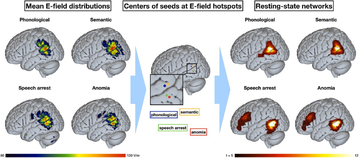 Thrilled to work with talented colleagues like <a href="/MarVasileiadi/">Maria Vasileiadi</a>, who used navigated TMS to explore how different subregions of the temporal gyrus affect language production 🧲🧠
👉 Peaks for phonological &amp; semantic errors in STG
👉 Peaks for anomia and speech arrest were in MTG
