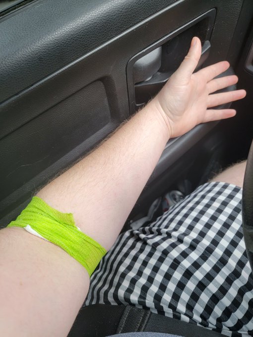 Completed a one year long monkeypox vaccine study today. 😊   This is a big deal for me bc I'm terrified