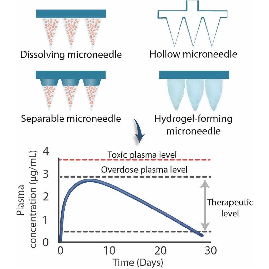 ADDReditors's tweet image. ADDR 50 days' free access: Long-acting microneedle formulations.
By Ryan F. Donnelly &amp;amp; coworkers @pharmacyatQUB @UKICRS @ryanfdonnelly 
#microneedle #longacting #intradermal 
authors.elsevier.com/sd/article/S01…
