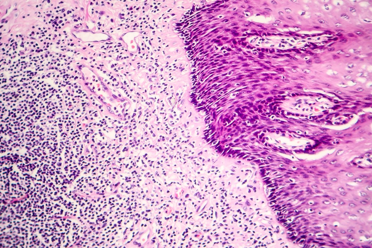 MedscapeObGyn's tweet image. Making one key connection may increase #HPVvax uptake ms.spr.ly/60109n2o0