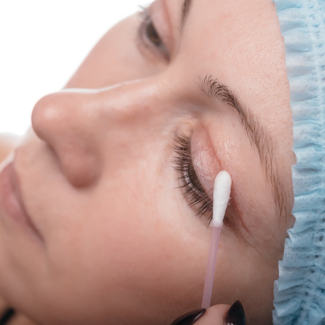 Upper Blepharoplasty

More: 1l.ink/MJ2QVTK

#AdvancedCosmeticSurgeryandLaserCenter #351Face #Botox #CosmeticSurgeon #Cincinnati #Ohio #PlasticSurgeon #MedicalSpa #Fillers #Skincare #Injectables #LaserTreatments #FaceLift #EyelidSurgery #Liposuction #Blepharoplasty