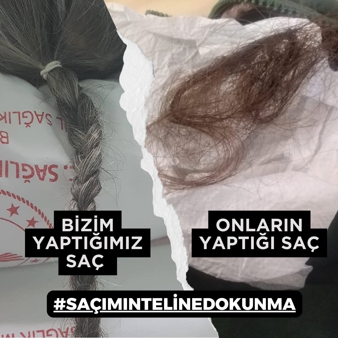 Bizim yaptığımız saç !

Onların yaptığı saç ! 

<a href="/drfahrettinkoca/">Dr. Fahrettin Koca</a> 
<a href="/saglikbakanligi/">T.C. Sağlık Bakanlığı</a> 
<a href="/ismgovtr/">İstanbul İl Sağlık Müdürlüğü</a> 

 #saçımıntelinedokunma