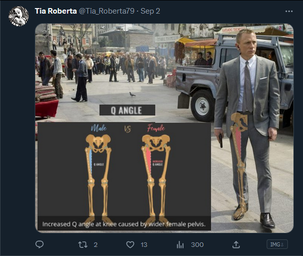 Eden_Paradise28's tweet photo. @RightWingCope this person transvestigates legs too btw https://t.co/LOK5CXpuu7