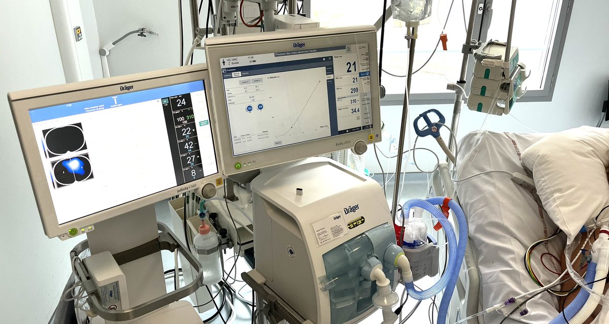 Roze Hadrien (@hadrienroze) on Twitter photo Still working on asymetrical lung injury in <a href="/CHCoteBasque/">CH Côte Basque</a> , results will be presented in Barcelona in a few weeks
Best congress on respiratory physiology see the program 👌
events.startpromotion.it/site/frontend/… Still working on asymetrical lung injury in <a href="/CHCoteBasque/">CH Côte Basque</a> , results will be presented in Barcelona in a few weeks
Best congress on respiratory physiology see the program 👌
events.startpromotion.it/site/frontend/…