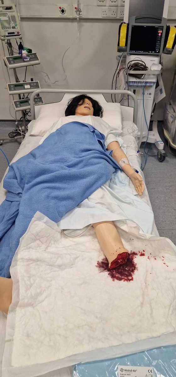 SimStars (@simstarsirl) on Twitter photo Utilising the Major Transfusion Protocol in our simulated amputation. Extremely well managed by the teams. <a href="/CorkTrauma/">Cork University Hospital Major Trauma Centre</a> <a href="/CuhANP/">CUH Advanced Nurse Practitioners</a> <a href="/DrRoryOBrien/">Rory O'Brien</a> <a href="/StephRyng/">Steph Ryng</a> #Trauma #Resus #Simulation Utilising the Major Transfusion Protocol in our simulated amputation. Extremely well managed by the teams. <a href="/CorkTrauma/">Cork University Hospital Major Trauma Centre</a> <a href="/CuhANP/">CUH Advanced Nurse Practitioners</a> <a href="/DrRoryOBrien/">Rory O'Brien</a> <a href="/StephRyng/">Steph Ryng</a> #Trauma #Resus #Simulation