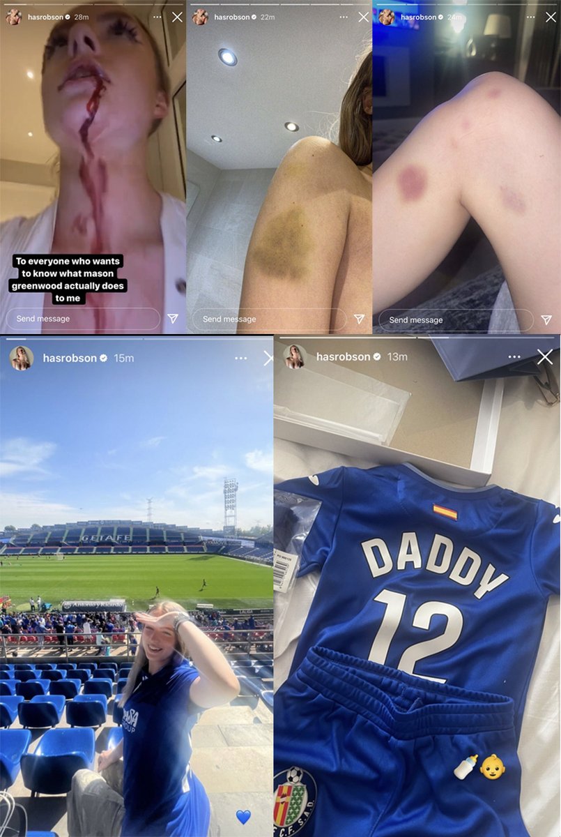 En 2022, Harriet Robson subió historias de Instagram denunciando violencia de género por parte de Mason Greenwood.

El futbolista fue detenido y lo apartaron del Man. United.

Hoy, en la presentación de Greenwood en el Getafe, ella estuvo presente y anunció que tendrán un hijo.