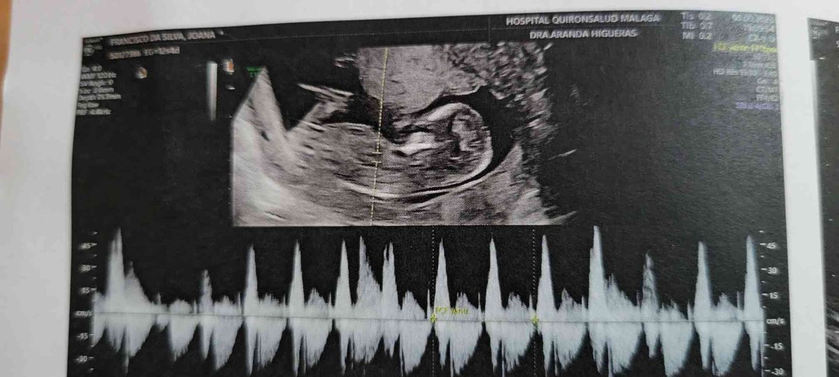 André Guilhoto tweet media