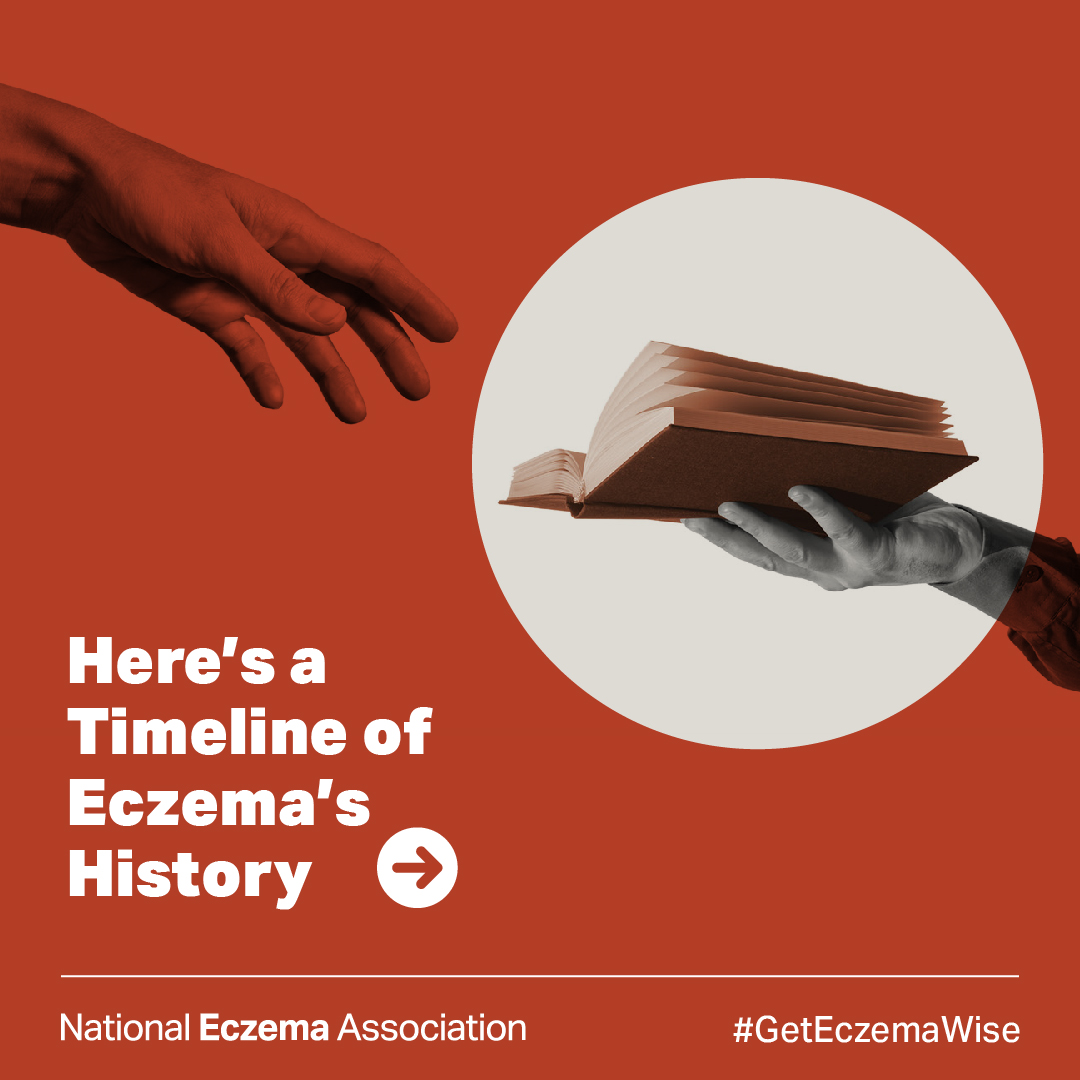 National Eczema tweet media