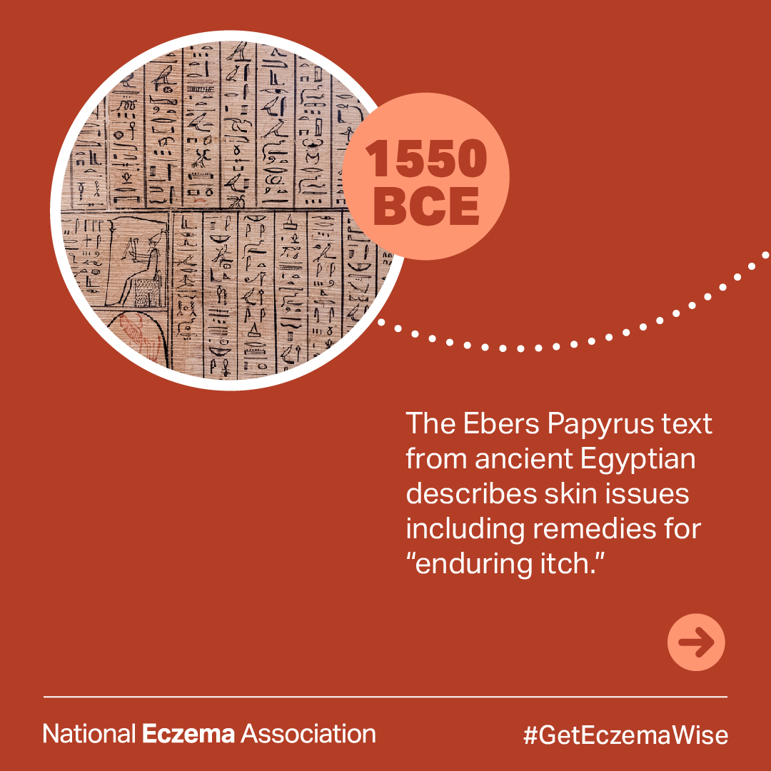 National Eczema tweet media