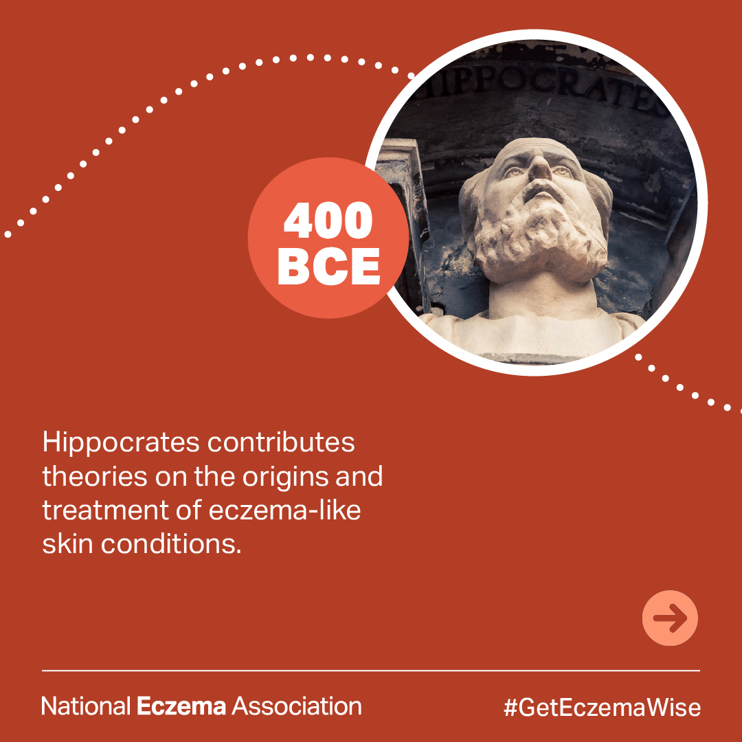 National Eczema tweet media