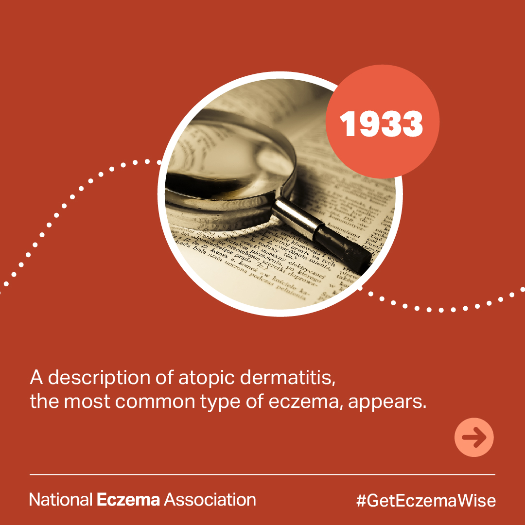 National Eczema tweet media