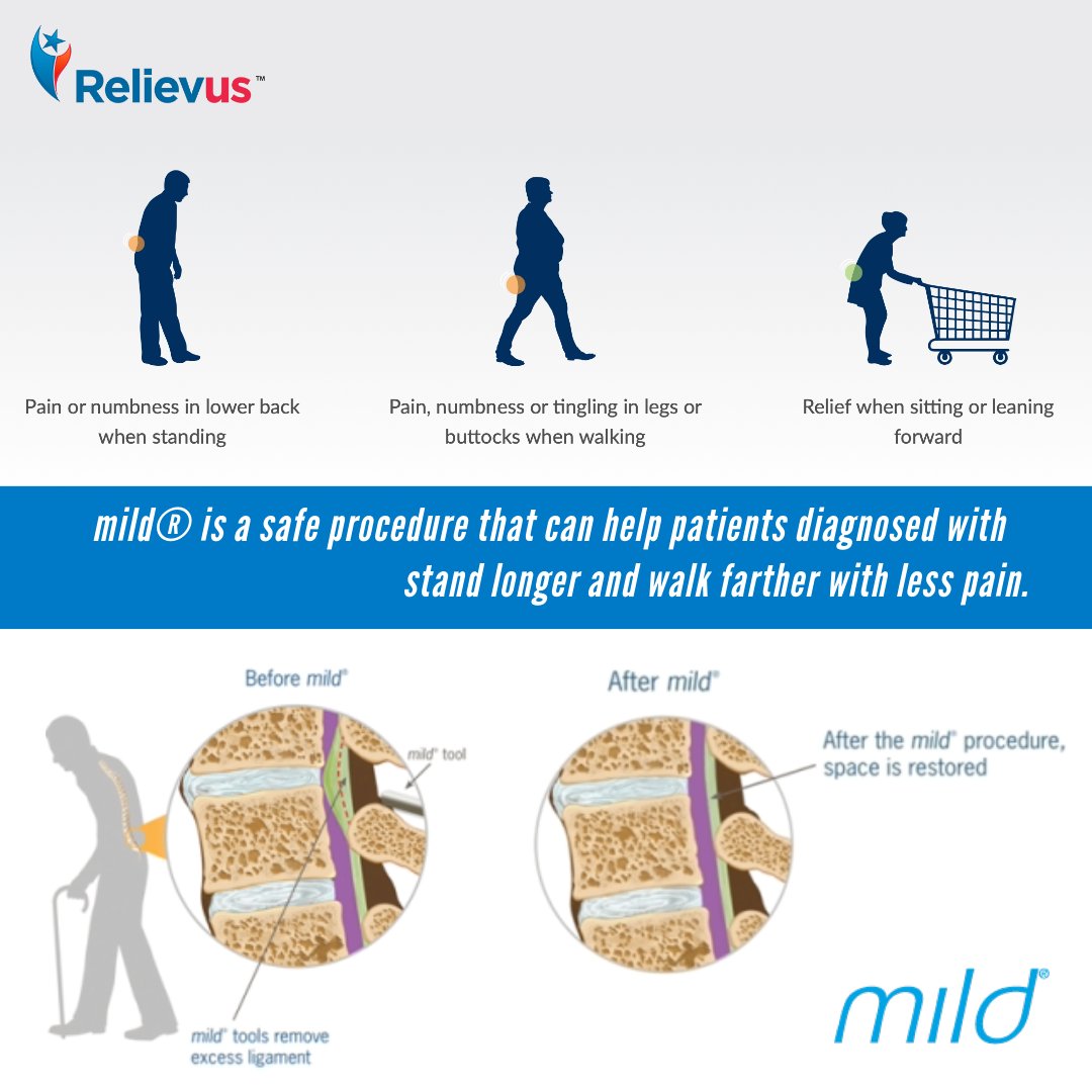 mild® is a safe procedure that can help patients diagnosed with lumbar spinal stenosis (LSS) stand longer and walk farther with less pain.

relievus.com/mild-procedure/

☎️888-985-2727

#painmanagement #managepain #relievus #relievepain #mildprocedure #righttreatment