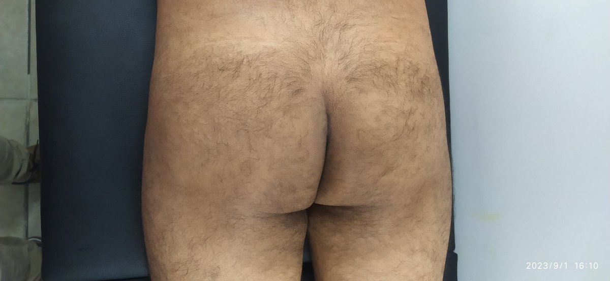 WaxingXander's tweet photo. Nuestro ganador quedó feliz con su 🍑  listo para usar 
Que esperas para realizar tu depilacion
@DeseosVipMich @UnderwearDKMich 
@MHot4233 https://t.co/yNP9vrgxVJ