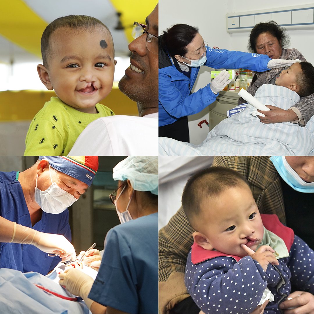 This September, we are heading to Guizhou in China and Karnataka in India to spread more smiles! 😀

#cleft #medicalmission #facialdeformity #children #volunteer #India #China