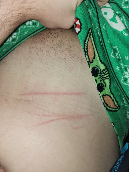 Sorry about getting off early guys I had some weird lines on my stomach and they hurt like hell https://t