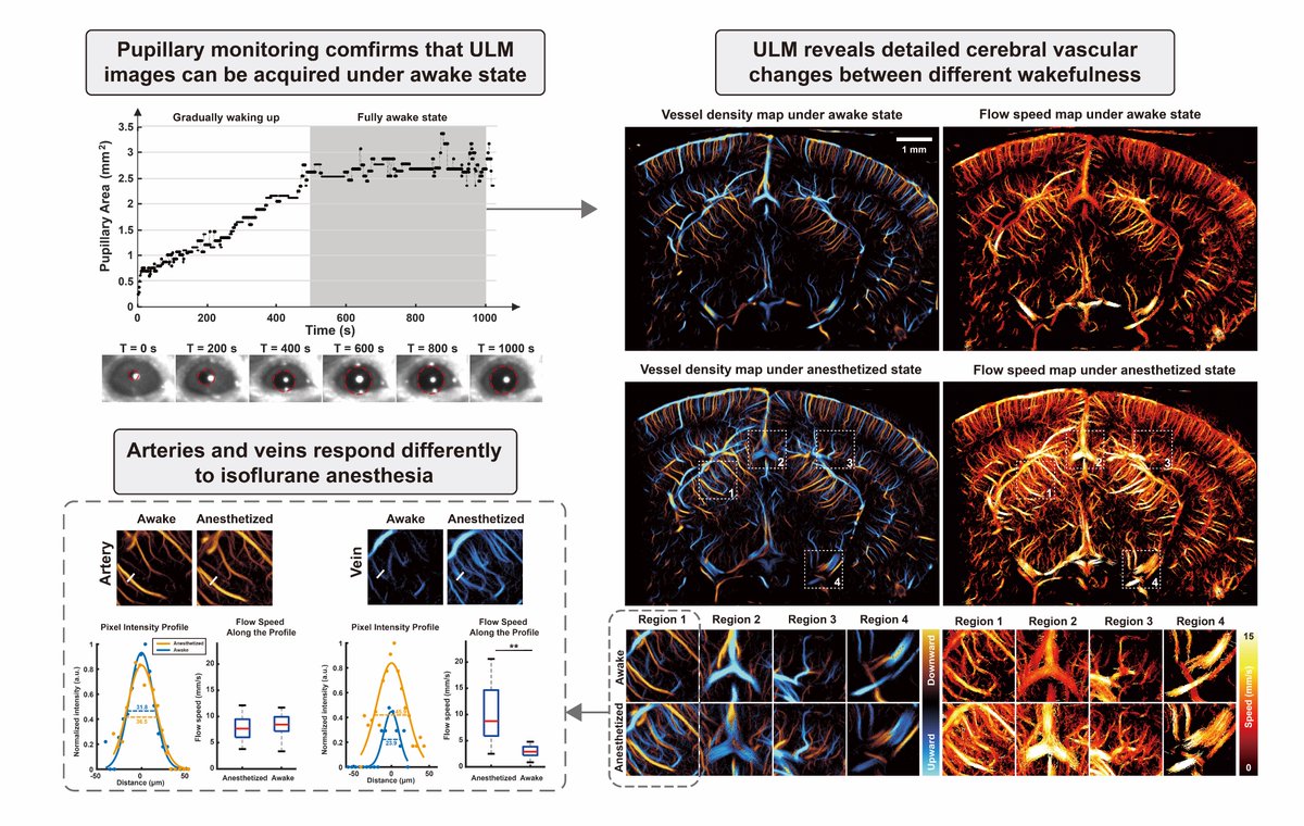 Is #ULM on awake mice possible? We think so! Check out our new work led by <a href="/YikeWang003/">Yike Wang</a>: we demonstrate awake and longitudinal ULM imaging of 🐭🧠. You can see the impact of anesthetics on cerebral blood flow -- something you can only visualize with ULM!

biorxiv.org/content/10.110…