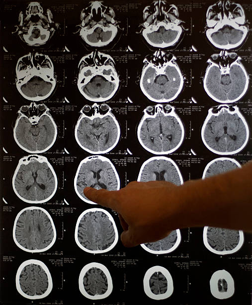 ecalixto's tweet photo. El cerebro de músicos profesionales tiene mayor conectividad funcional en las regiones auditivas de ambos hemisferios cerebrales y mayor materia blanca en áreas de procesamiento de alto nivel.
#NeuroTuit
Leipold S et al.  J Neurosci. JN-RM-1985-20. doi: 10.1523/JNeurosci.1985-20. https://t.co/dFFtVypzZa