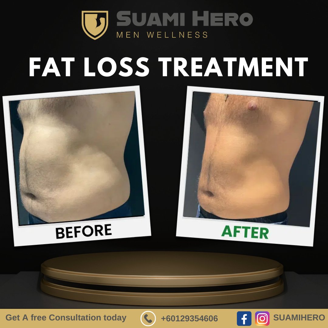SuamiHero's tweet photo. See results develop over the following 4-12 weeks as the fat cells shrink and the fat is removed from your body. 

Untuk Maklumat yang lebih lanjut:
012-9354606 (Mr Gibson)

#SuamiHero #KesihatanLelaki #menshealth #fitness #health #mensfitness #men #fitnessmotivation #gym https://t.co/Vj3XLNBnR8
