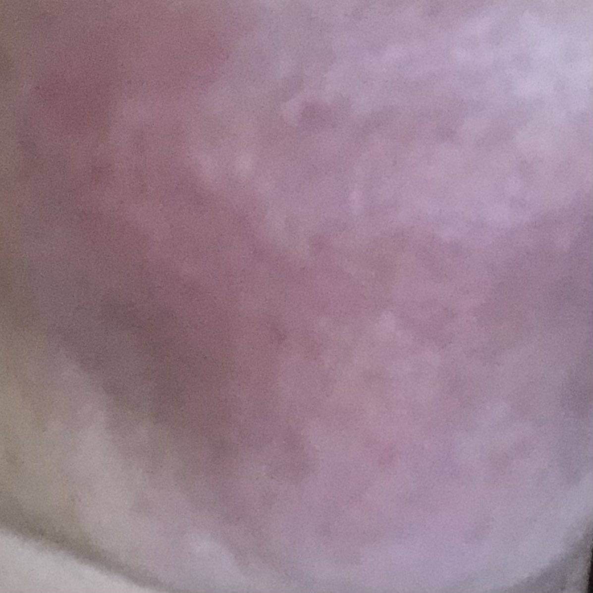 KatTweetsTech's tweet image. Here’s a blurry photo of a spot on my chin that I am calling ${redacted}ContactId on account of my current API integration suffering.

That is all.