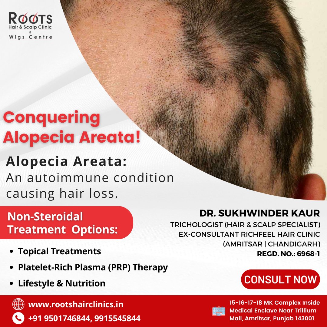 'Embracing My Roots: Sharing my journey with alopecia areata, 
.
📱 : 9501746844
.
🌎Visit: rootshairclinics.in
.
🌎 instagram.com/roots.hair.cli…
.
#Rootshairscalpclinic #Drsukhwinderkaur #AlopeciaAwareness #RootedInStrength #HairLossJourney #SelfLove #AlopeciaWarrior
