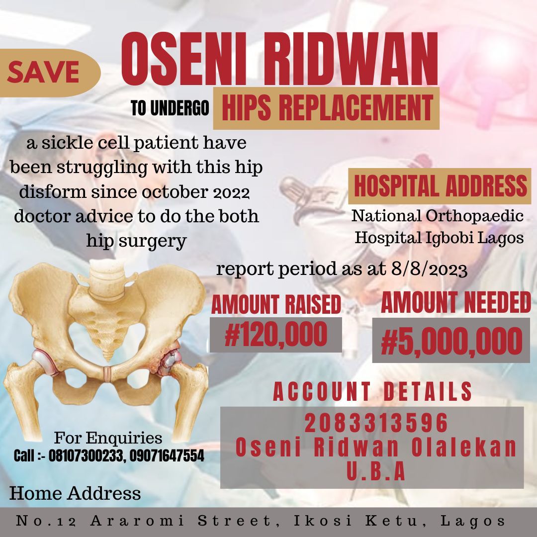 hishabdulhakeem's tweet photo. It is disheartening to hear this but who are we for God not to test. 
We urge the General Public to kindly assist us in making OSENI RIDWAN a complete man again.
It is recommended that the hips socket needs an urgent surgery to be attended to
2083313596
Oseni Ridwan Olalekan UBA https://t.co/ApDOHNNE05