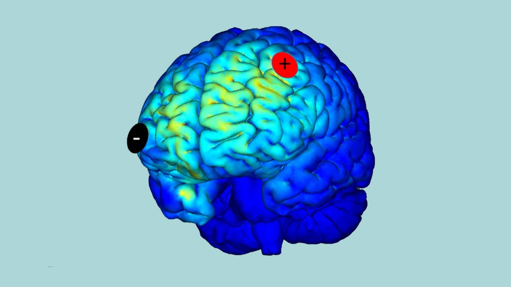 F.R.S.-FNRS (@frsfnrs) on Twitter photo 🧠 De nouvelles perspectives encourageantes pour le traitement des troubles de la conscience 🧠
➡ Une étude internationale dirigée par le <a href="/Coma_Science/">Coma Science Group</a> <a href="/UniversiteLiege/">Université de Liège</a> <a href="/frsFNRS/">F.R.S.-FNRS</a> <a href="/CHULiege/">CHU de Liège</a> impliquant plus de dix institutions :
news.uliege.be/cms/c_18788781… 🧠 De nouvelles perspectives encourageantes pour le traitement des troubles de la conscience 🧠
➡ Une étude internationale dirigée par le <a href="/Coma_Science/">Coma Science Group</a> <a href="/UniversiteLiege/">Université de Liège</a> <a href="/frsFNRS/">F.R.S.-FNRS</a> <a href="/CHULiege/">CHU de Liège</a> impliquant plus de dix institutions :
news.uliege.be/cms/c_18788781…