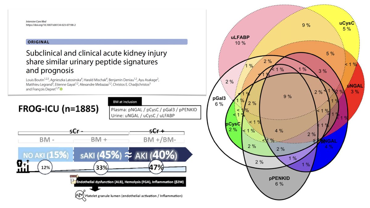 🫘 🧪 Renal biomarkers can be used to define/identify of subclinical acute kidney injury, frequent &amp; severe condition with prognosis equivalent to #AKI, as defined by <a href="/goKDIGO/">KDIGO</a> criteria based on ⬆️ serum creatinine: ancillary analysis of FROG-ICU study 🐸
🔓rdcu.be/dlsf9