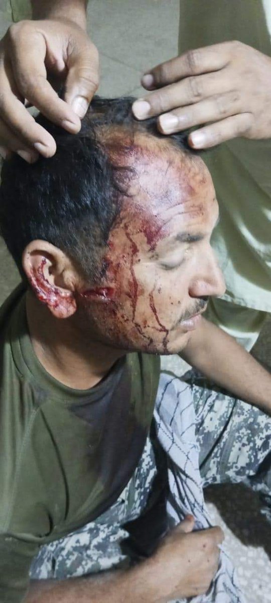 qazisabah09's tweet photo. As per the sources, One soldier of Chitral scouts died and 6 were seriously injured.
@ARYNEWSOFFICIAL
@ARYSabirShakir @geonews_urdu
@BOLNETWORK @humnews_urdu
#Savechitral #chitralattacked #chitral https://t.co/IWFv4RTIYO
