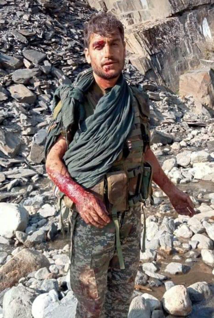 qazisabah09's tweet photo. More injured soldiers of Chitral scouts were brought.
#SaveChitral #Chitral https://t.co/L8vsKvqS0J