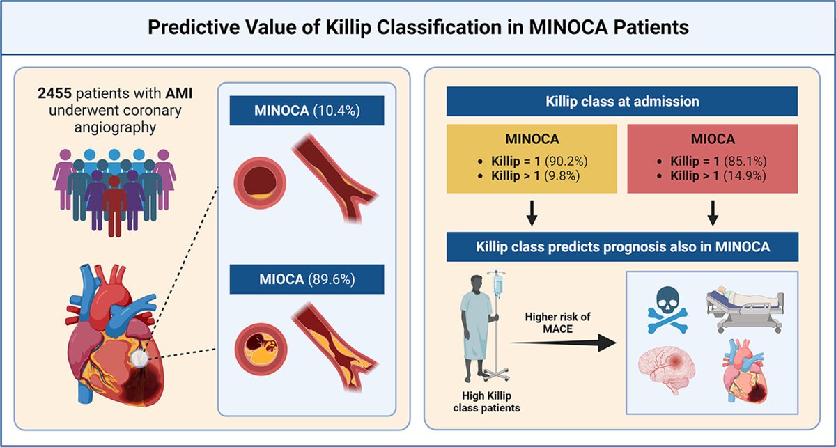 Matteo Armillotta (@matt_armi) on Twitter photo 🚨 Predictive value of Killip class 🩺 in MINOCA
➡️ High Killip class is an independent predictor of MACE and death in MINOCA
➡️ High Killip class MINOCA show a higher risk of HF than MIOCA counterparts
Explore our latest paper on <a href="/EJIM_journal/">European Journal of Internal Medicine</a> 👇
sciencedirect.com/science/articl… 🚨 Predictive value of Killip class 🩺 in MINOCA
➡️ High Killip class is an independent predictor of MACE and death in MINOCA
➡️ High Killip class MINOCA show a higher risk of HF than MIOCA counterparts
Explore our latest paper on <a href="/EJIM_journal/">European Journal of Internal Medicine</a> 👇
sciencedirect.com/science/articl…