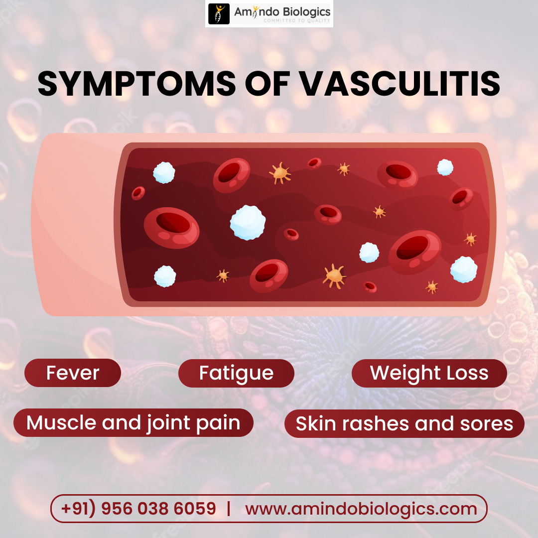 Understanding Vasculitis: Unraveling the Symptoms. If you or someone you know is experiencing any of these signs, it's time to seek help.
Learn more at amindobiologics.com or call +91 9560386059.
#VasculitisAwareness #Symptoms #HealthMatters #HealthAwareness #GetInformed