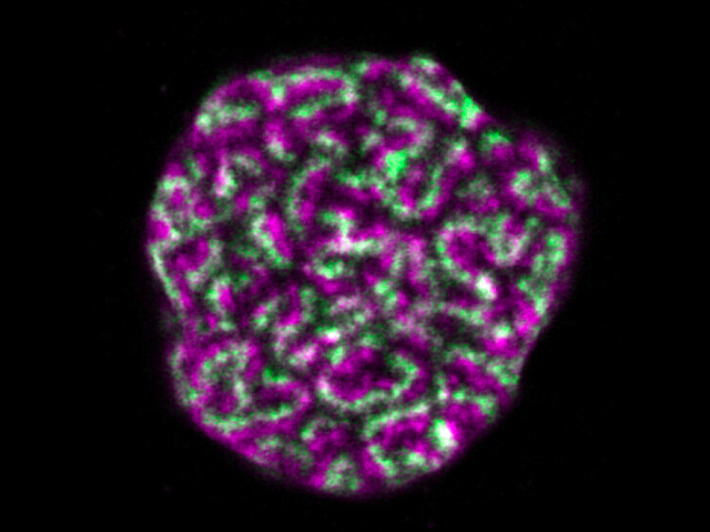 BPoD_s's tweet image. Sisters in Arms – Detailed structure of sister chromatids – the copies of a chromosome as #DNA is replicated – during the #cellcycle &amp;amp; division in human #cells. Image &amp;amp; research by Paul Batty et al @gerlich_daniel lab @IMBA_Vienna in @embojournal. On bpod.mrc.ac.uk/archive/2023/9…