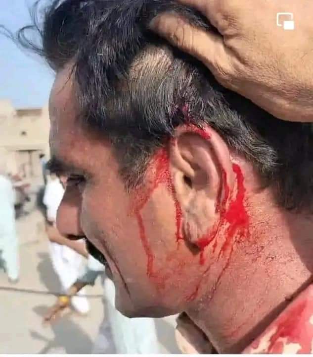 Strongly Condemned Police attack on peaceful protest at kandhkot.IGP Sindh taken action against culprits.
