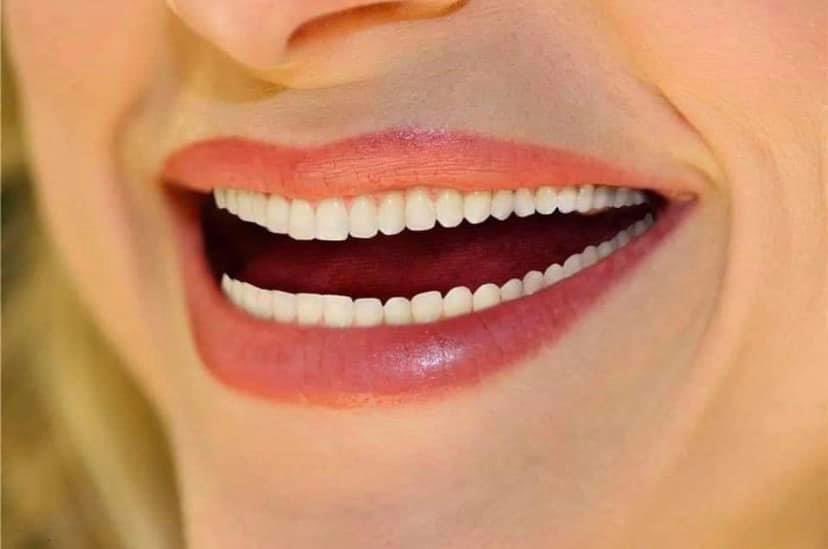 When the graphic designer doesn’t know much about odontology 🤣🤣 👄