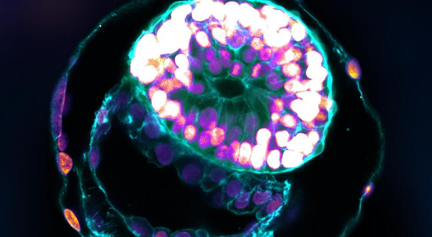 Not science fiction: Israeli researchers created embryo models in a lab! 14 day old embryo created from stem cells collected from mice

bit.ly/45DkYdz