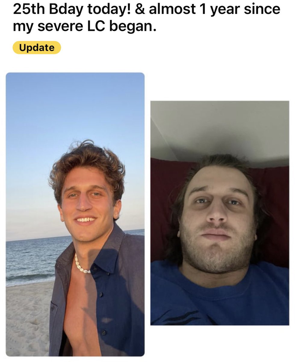 “The first photo is of me on one of my last family vacations before getting sick from #LongCovid — &amp; the second one is of me today completely bedridden, 20 pounds heavier, but holding a lot of fright behind those eyes.”

“I hope the absolute best for everyone.. you’re not alone.”